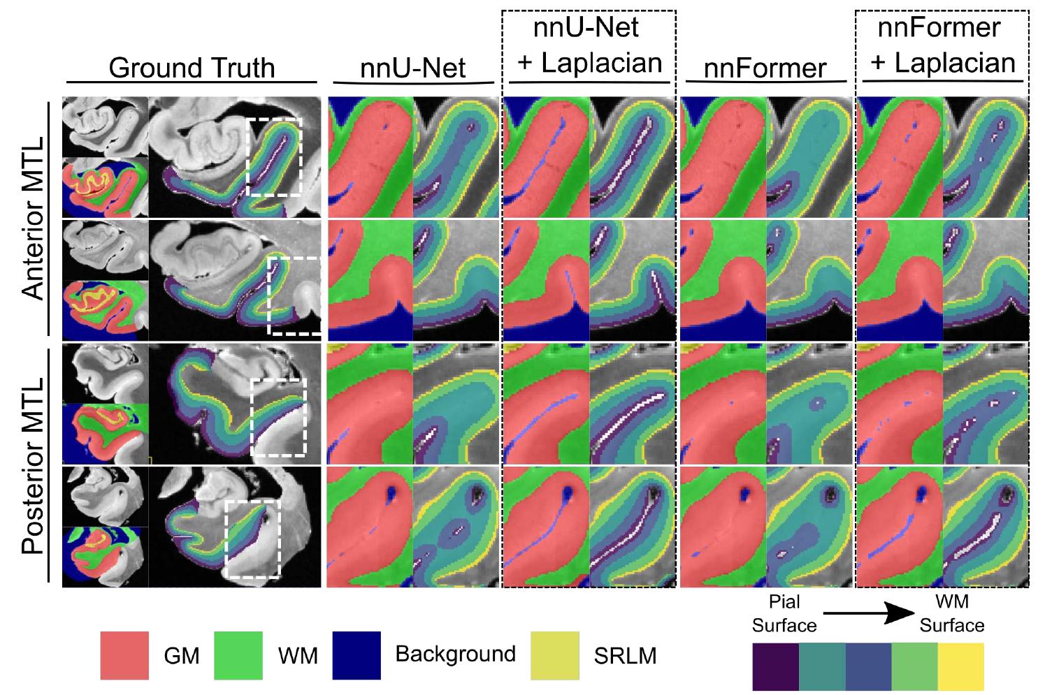 (PDF) Improved Segmentation of Deep Sulci in Cortical Gray Matter Using ...