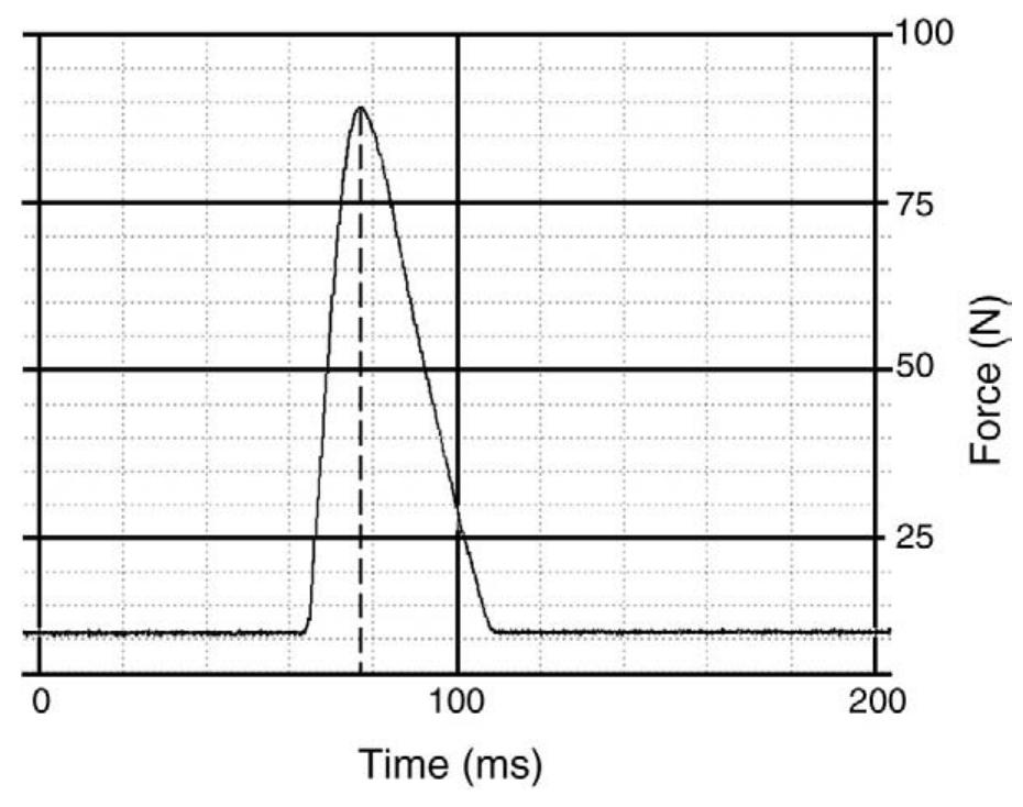 (PDF) Force-Time Profile Characterization of the McTimoney Toggle ...
