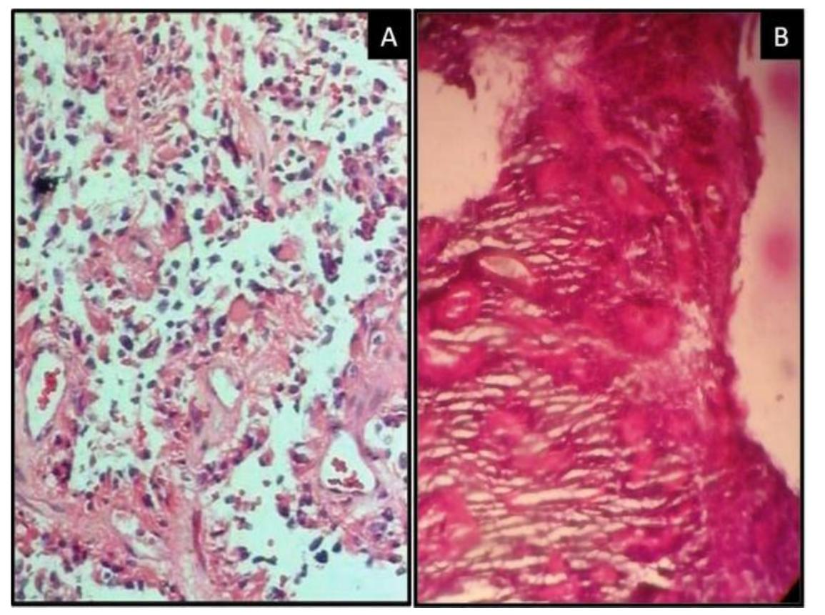 Figure 3 - Histopathological Study of Spectrum of the
