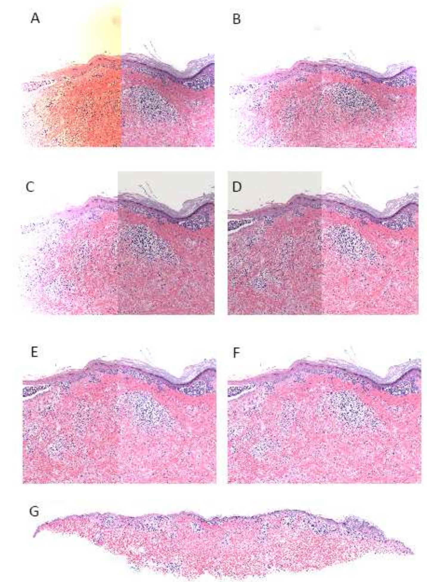 Parfocality (PDF) How to take better photomicrographs: A step-wise approach