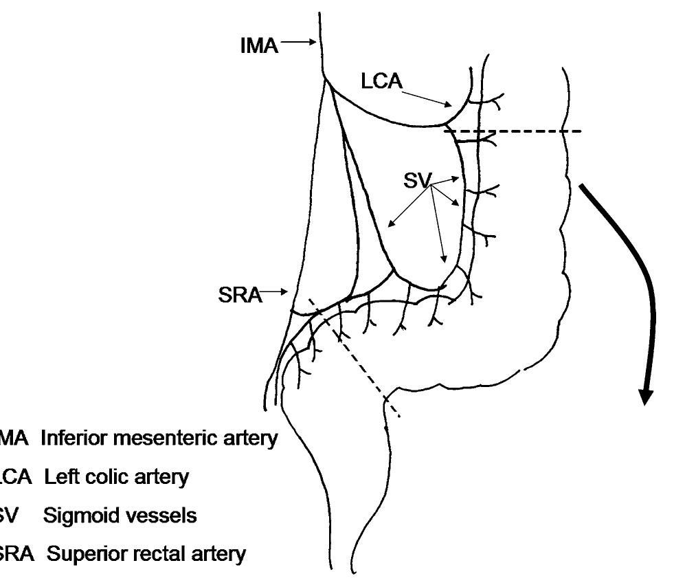 Figure 2 - from Colon replacement of vagina to restore