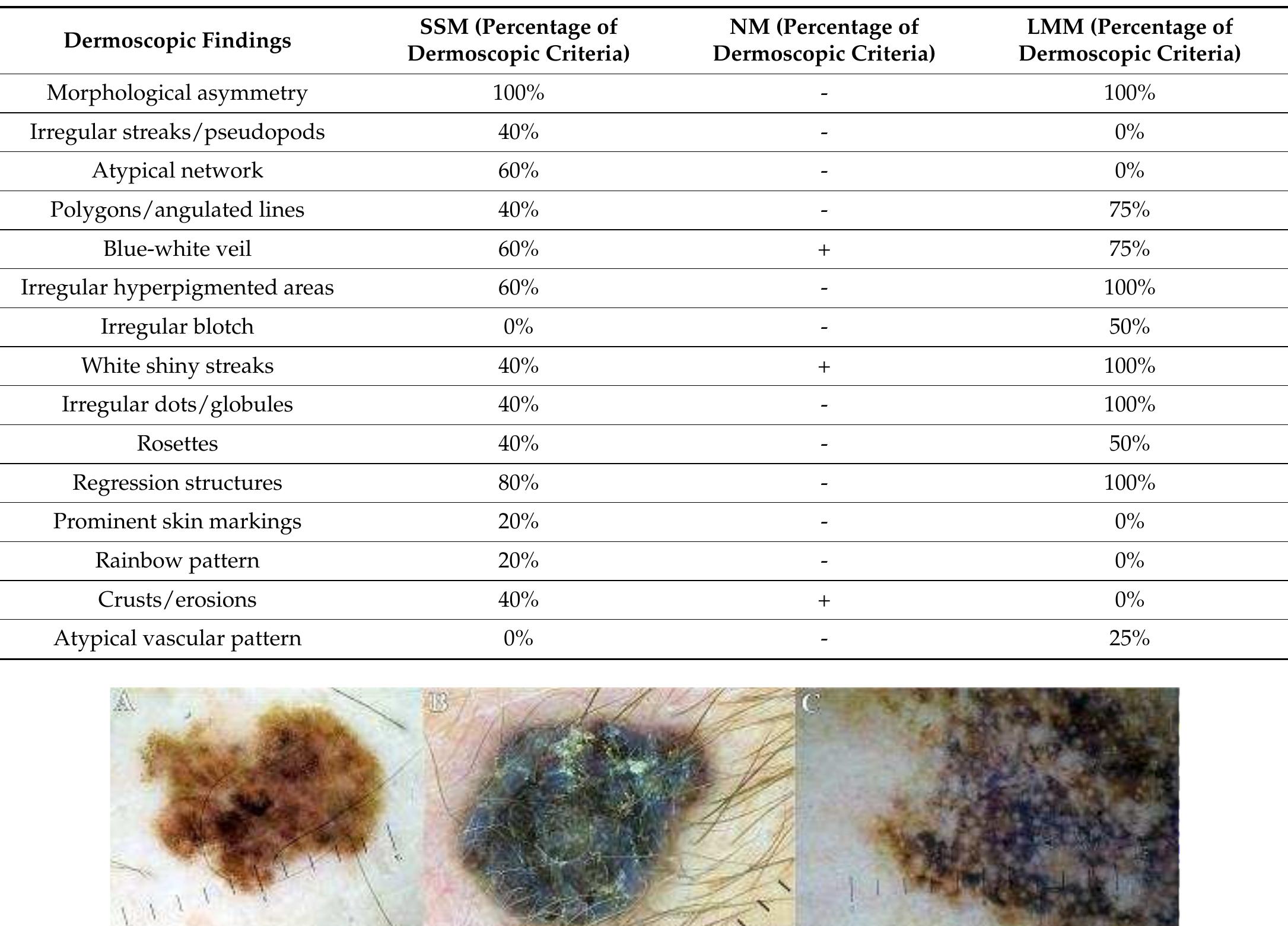 (PDF) The Many Roles of Dermoscopy in Melanoma Detection