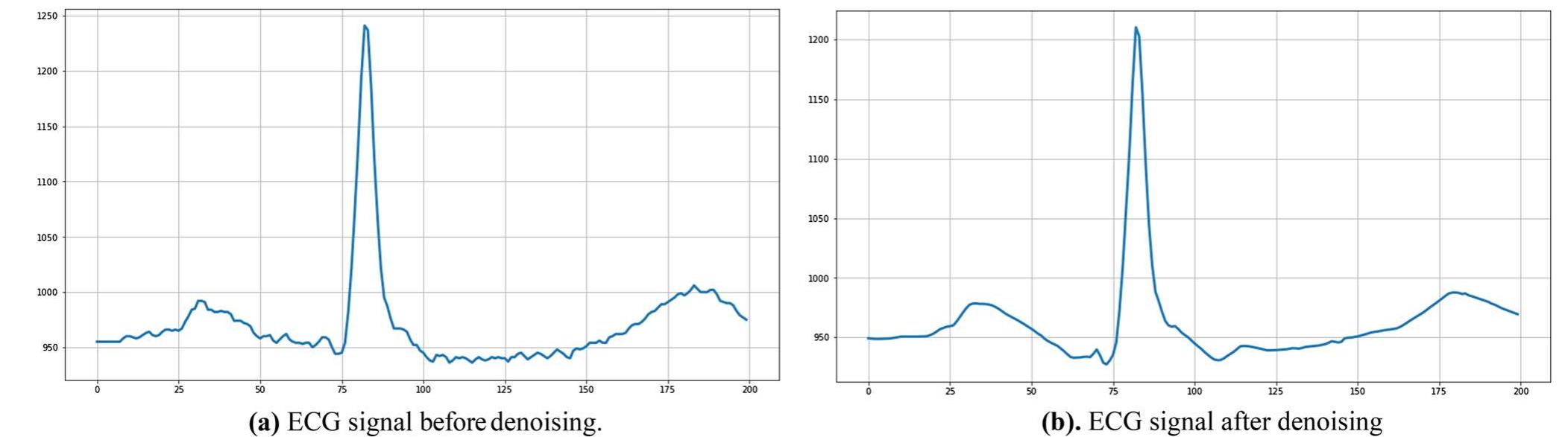 (PDF) Detection of Arrhythmia Heartbeats from ECG Signal Using Wavelet ...