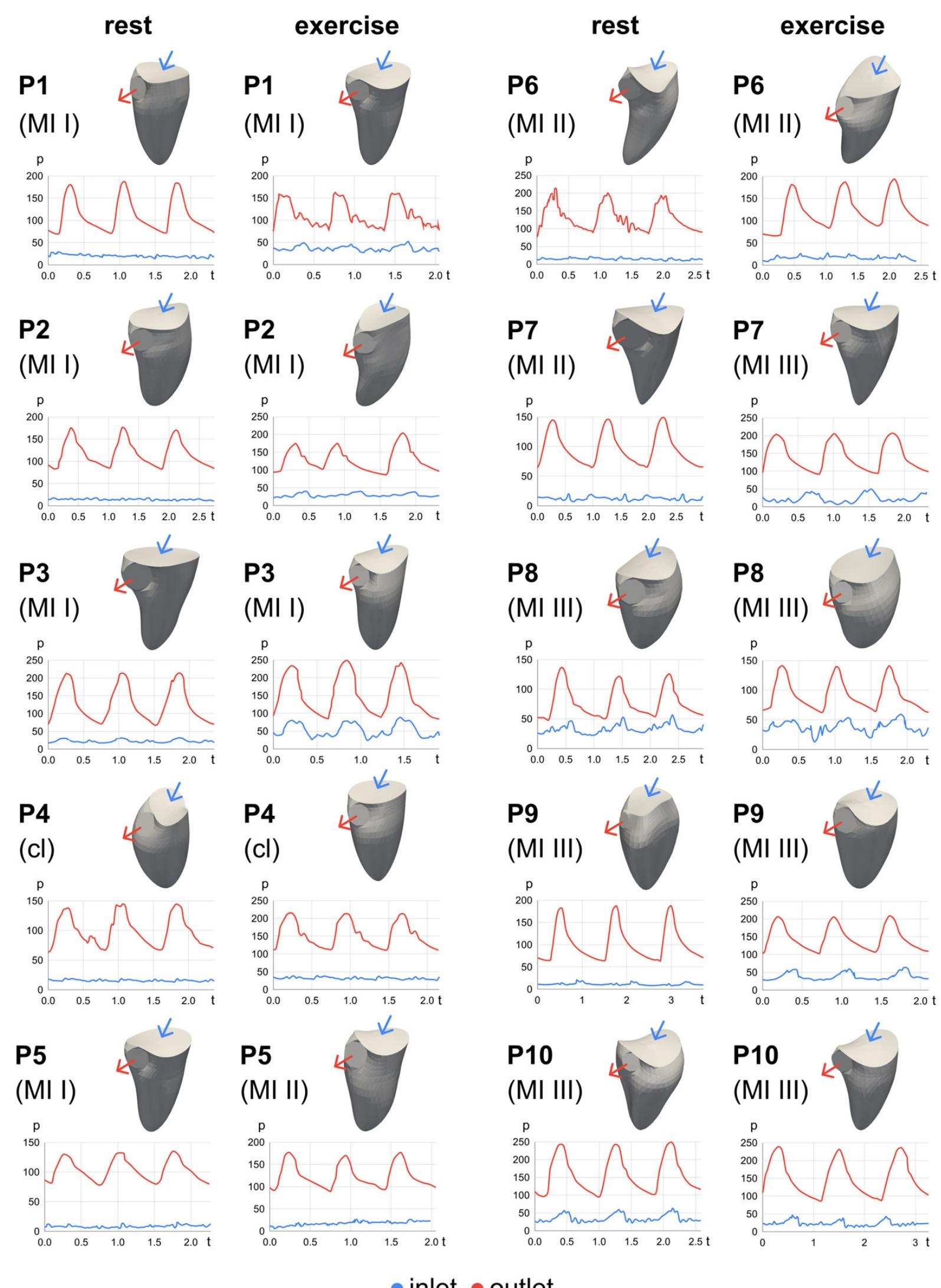 (PDF) Hemodynamic Assessment of the Pathological Left Ventricle ...