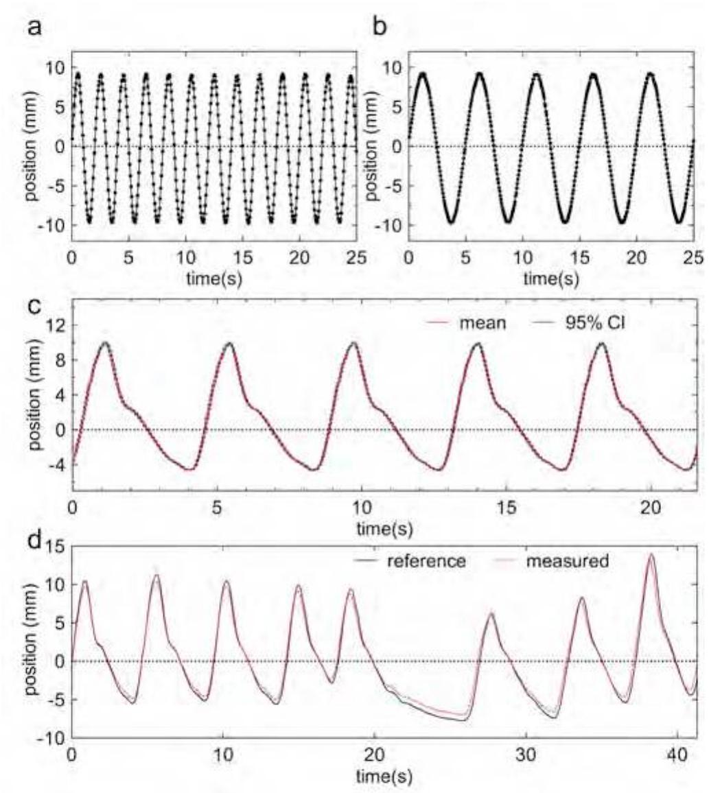 (PDF) Design and evaluation of an MRI-compatible linear motion stage