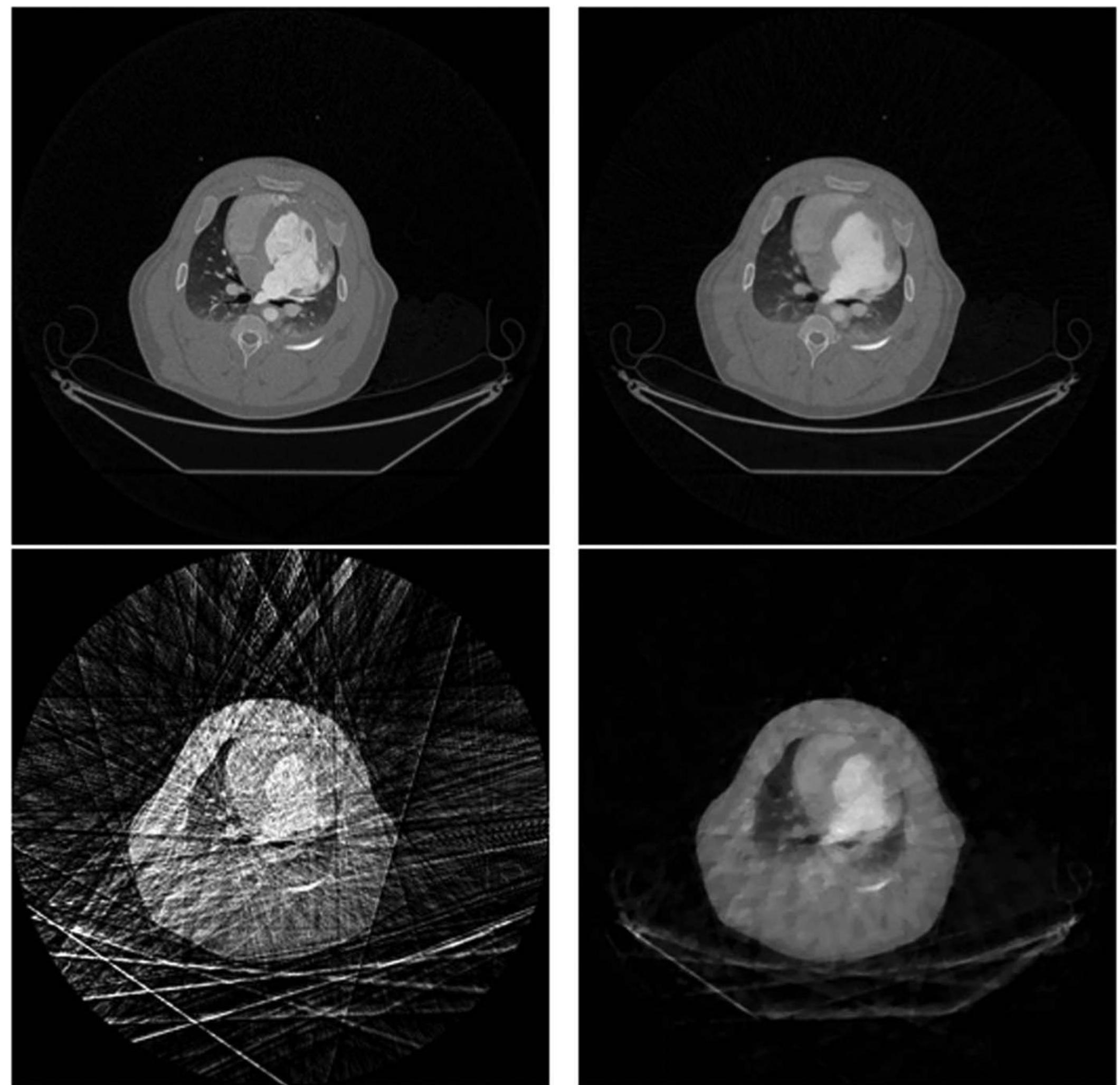 (PDF) Prior image constrained compressed sensing (PICCS): A method to ...