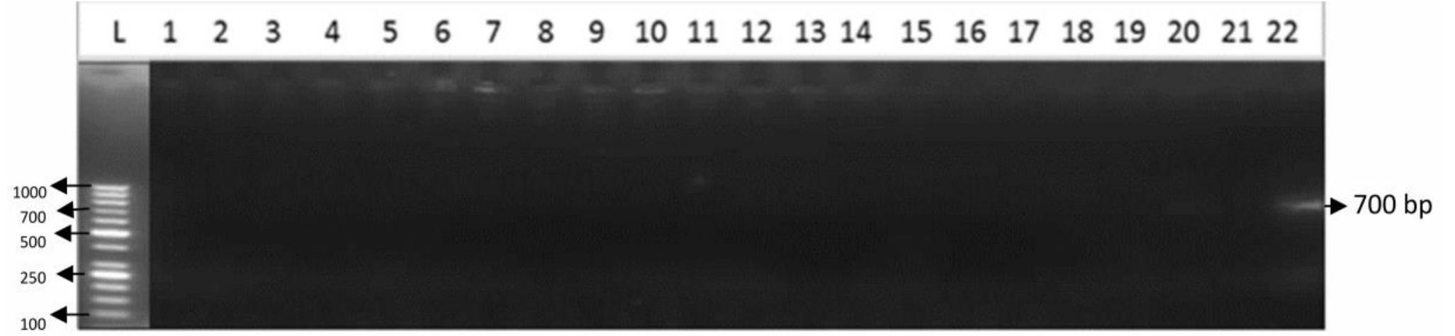 Bacterial Ruler Figure 5 - from Screening of different rice (Oryza sativa