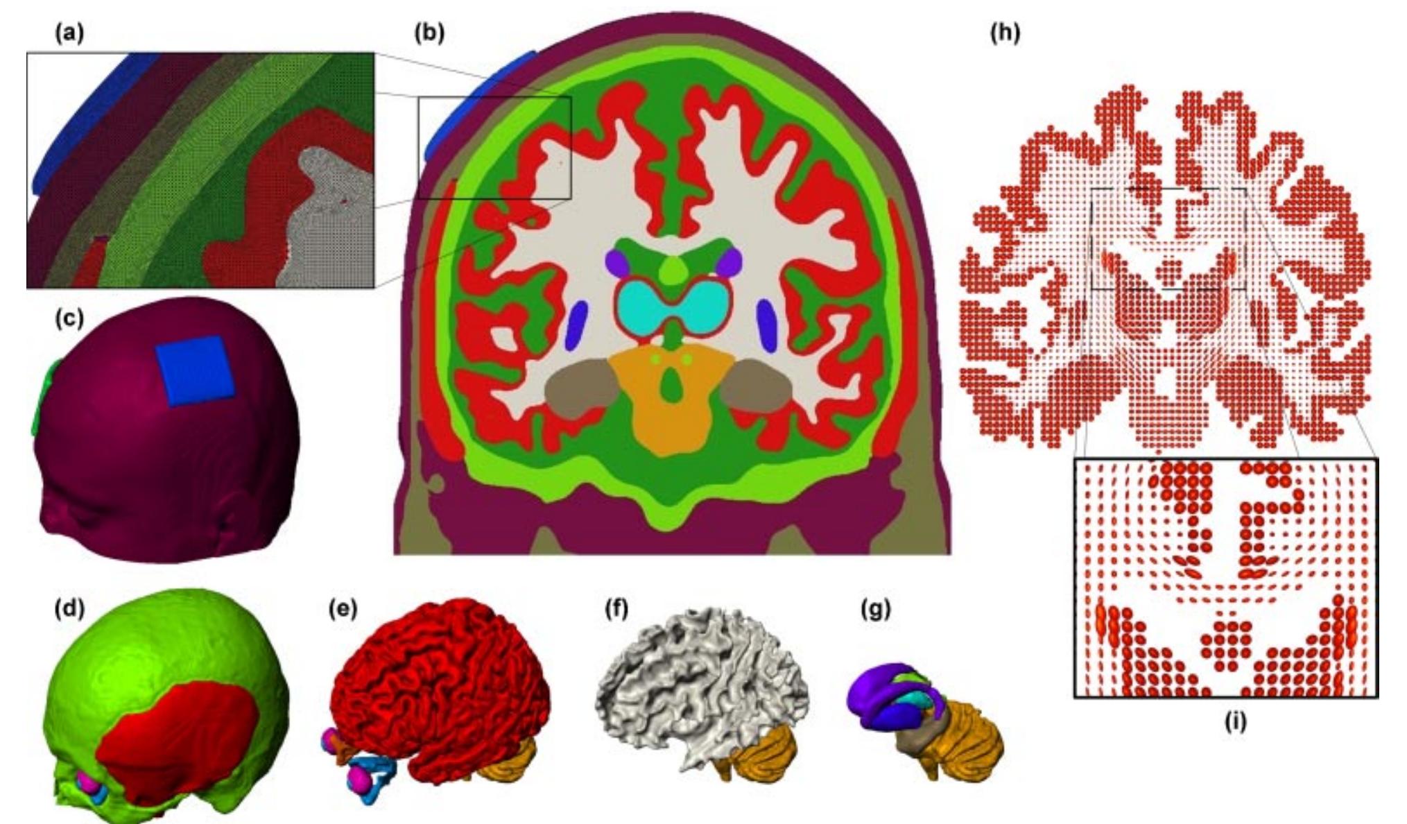 A: the zoomed section of the coronal slice of the head model