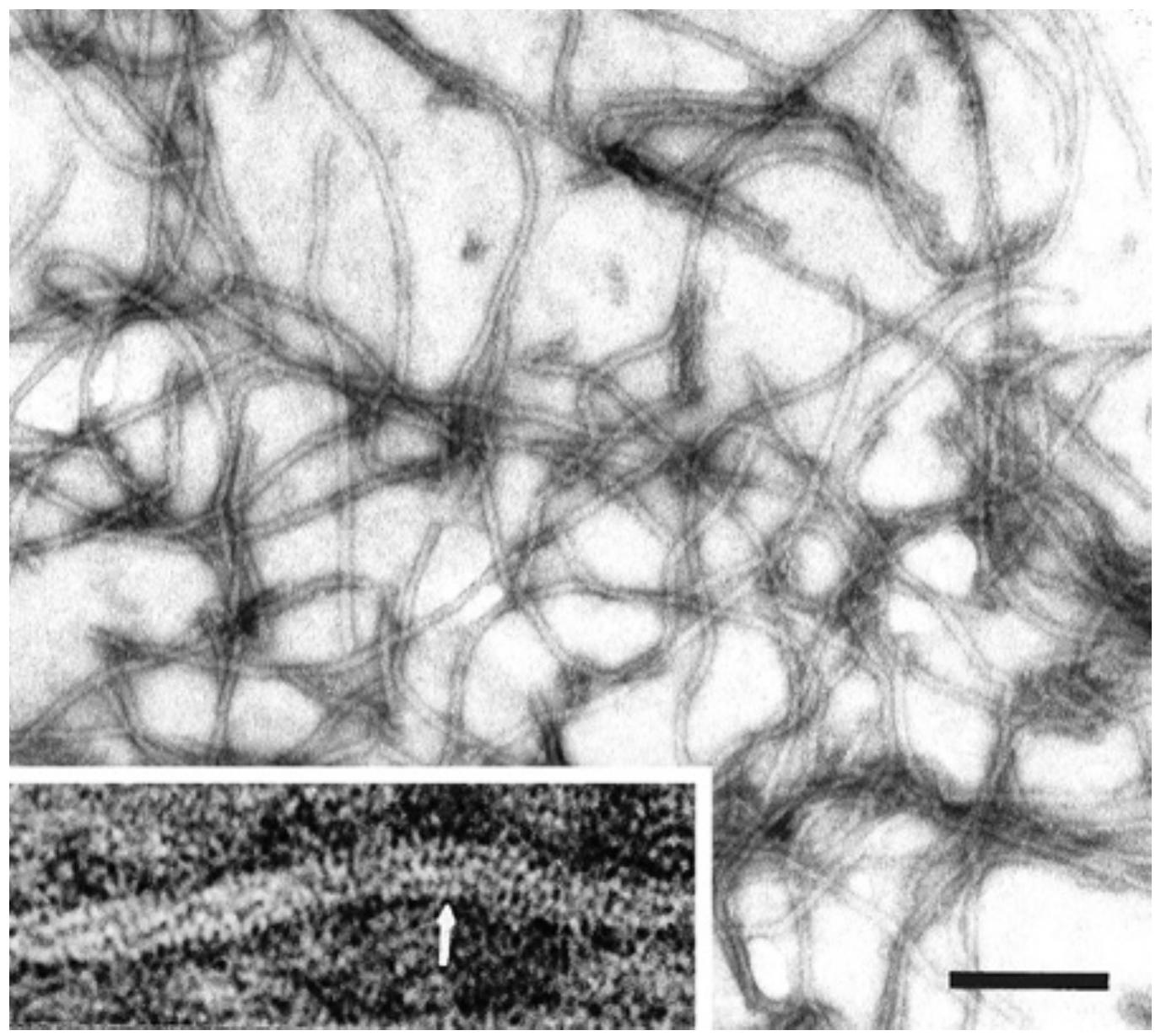 Flexuous Rods Particles (PDF) Ecology and Epidemiology of Whitefly-Transmitted Closteroviruses