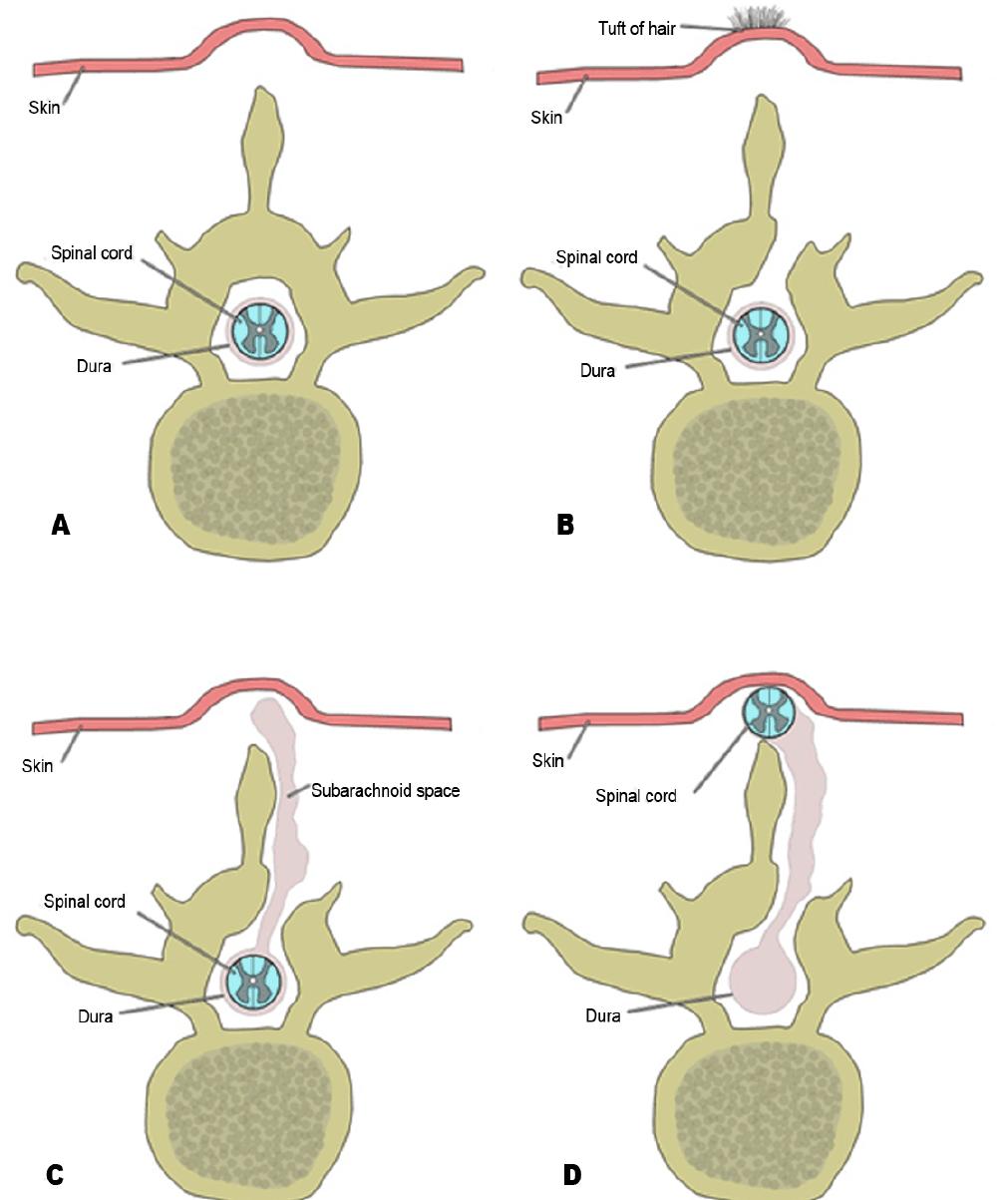 Figure 5 - from Neuroembryology and Development of the