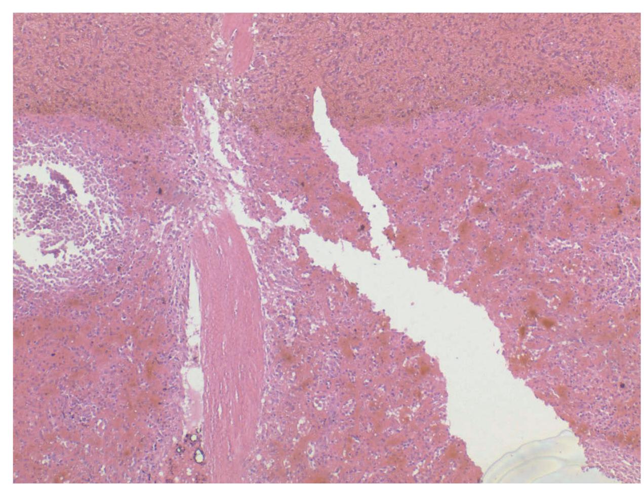 (PDF) An assessment of decoverslipping methods on histology slides