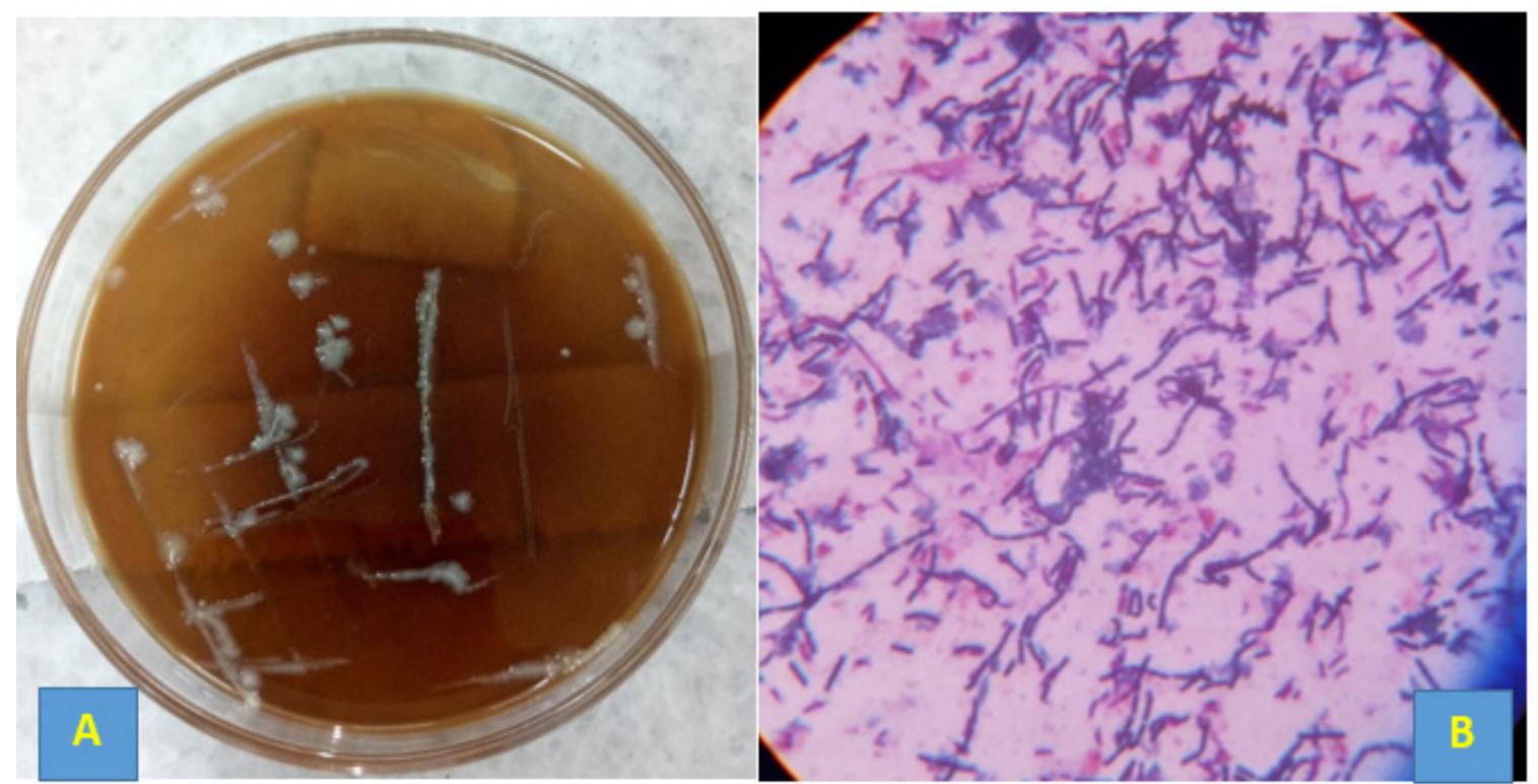 (PDF) Caseous lymphadenitis: A case of sheep and its management in Ethiopia