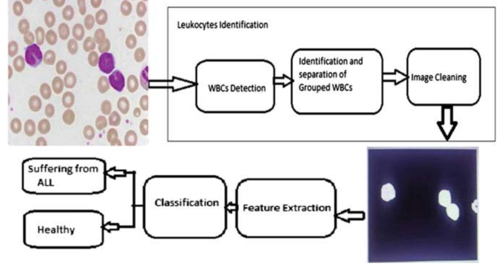 (PDF) Blood Cancer Detection with Microscopic Images Using Machine Learning