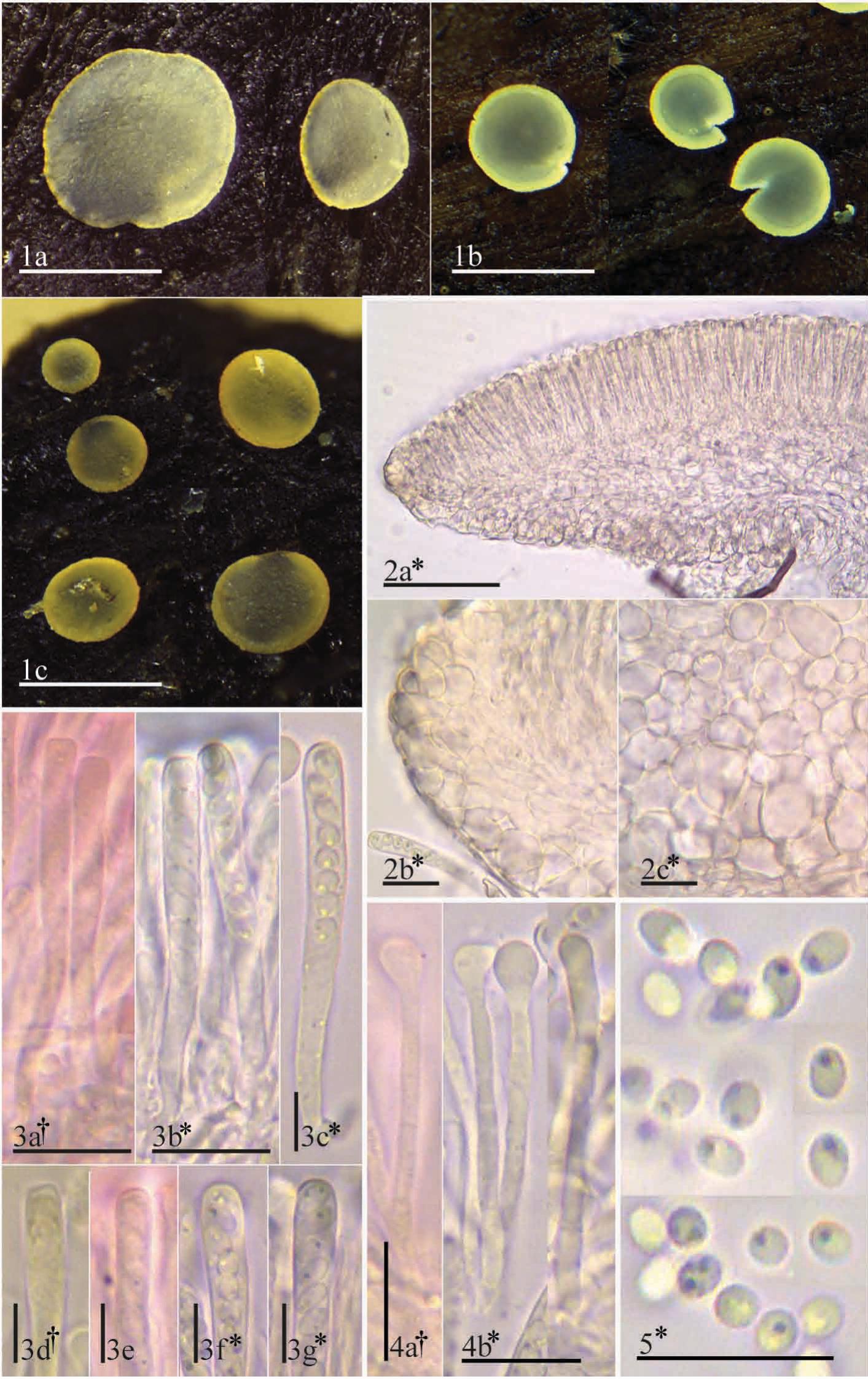 (PDF) A revision of the genus Orbilia in the Canary Islands