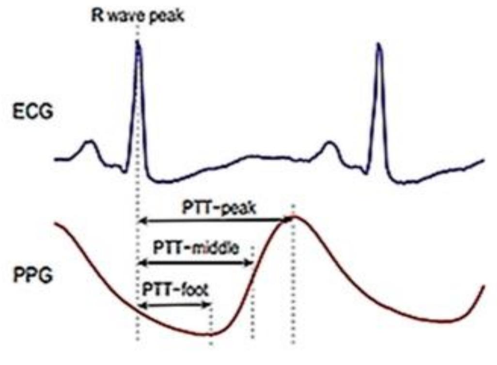 (PDF) A New Algorithm for Measuring Pulse Transit Time from ECG and PPG ...