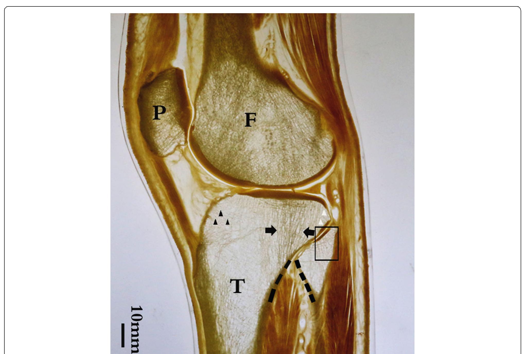 Parasagittal p45 section of the knee joint including the