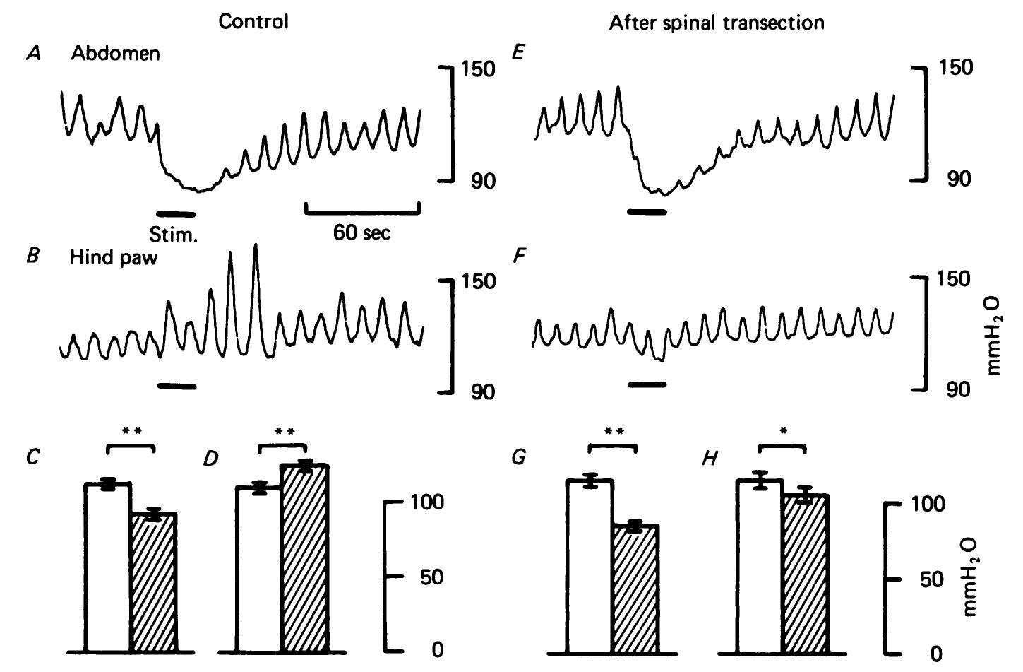Sample Devide Refler Retch (PDF) Neural mechanisms of reflex facilitation and inhibition of ...