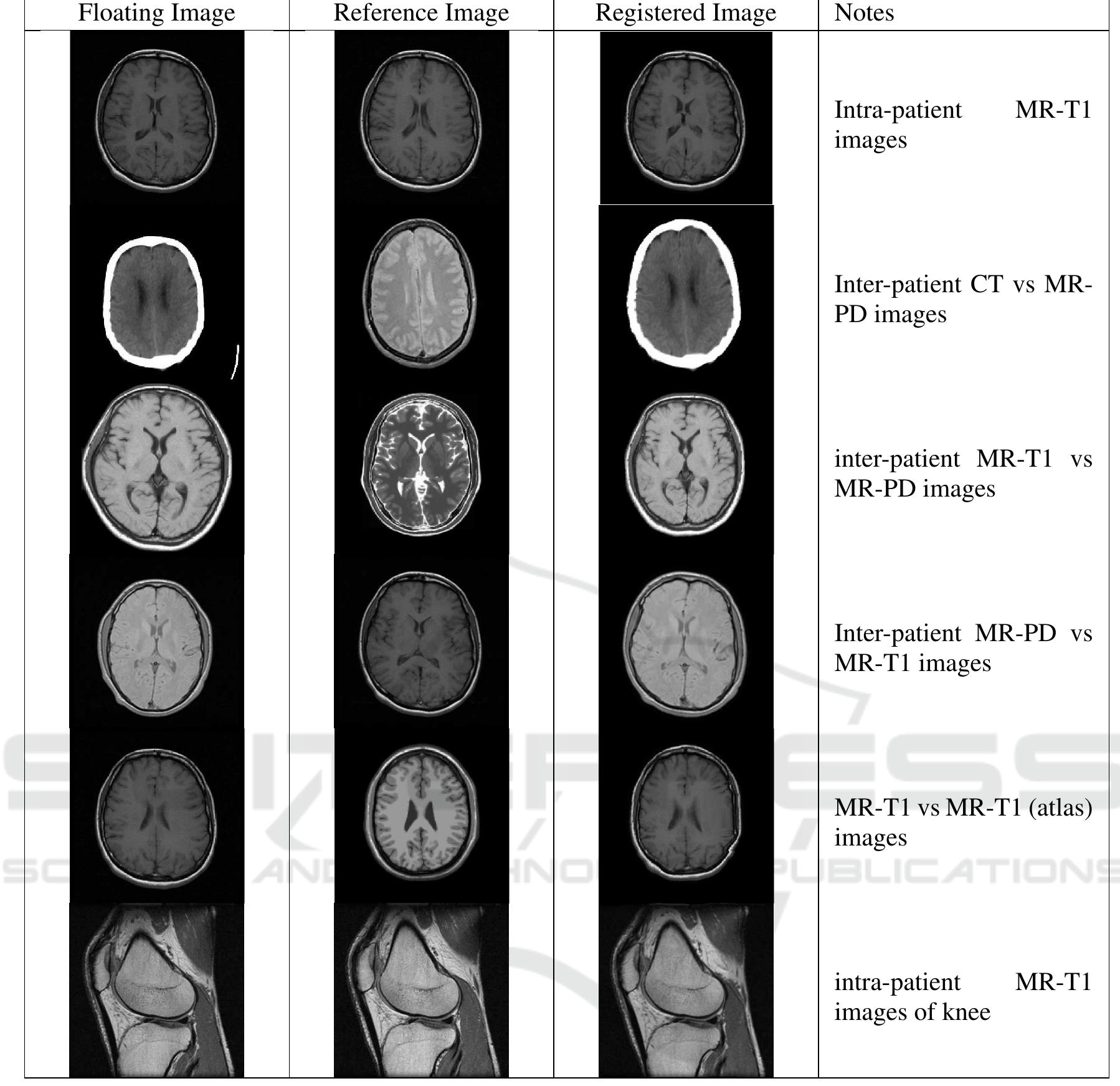 (PDF) Multi-modal Medical Image Registration by Local Affine ...