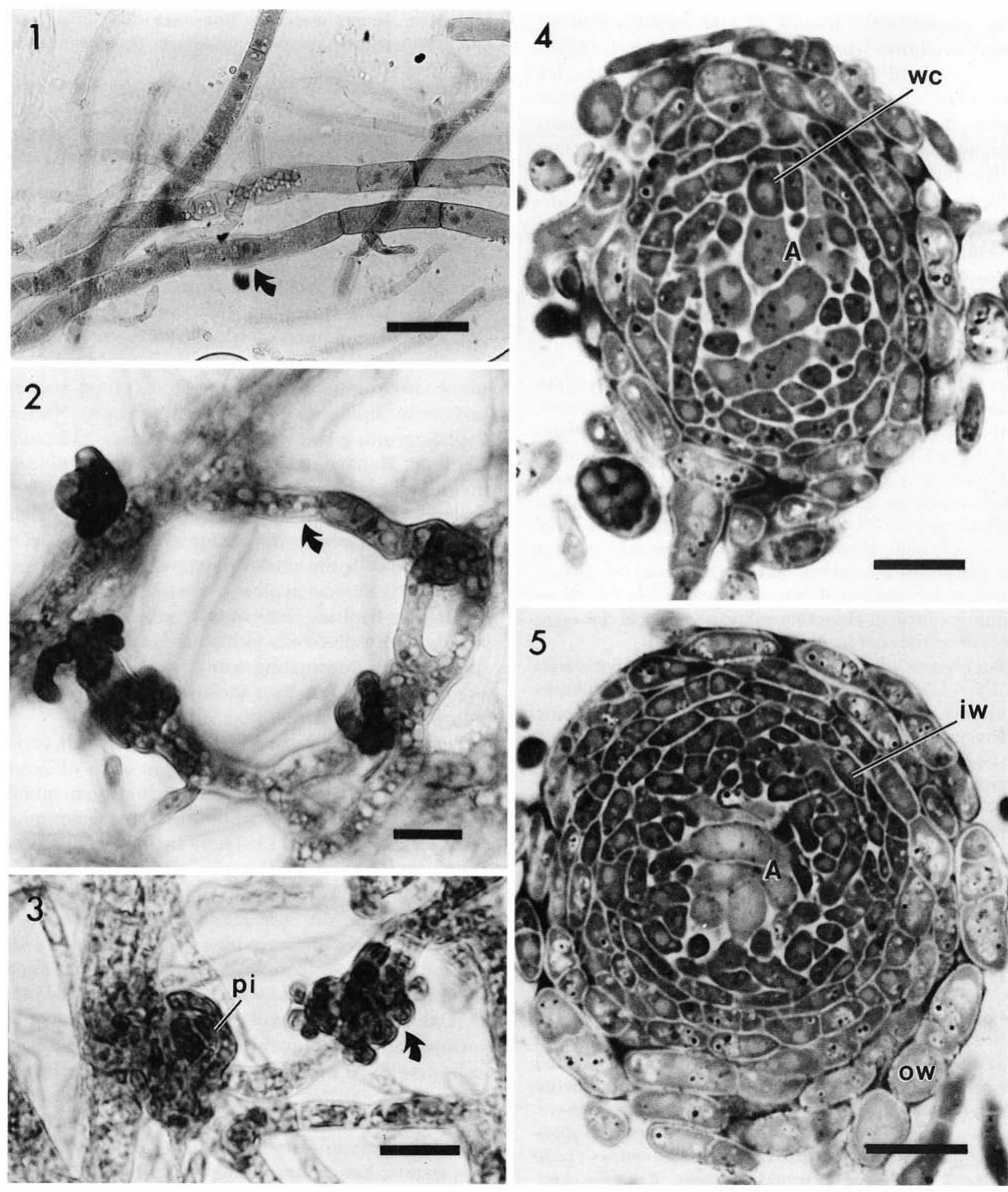 Perithecia Neonectria (PDF) Perithecial Development by Gibberella zeae: A Light Microscopy Study