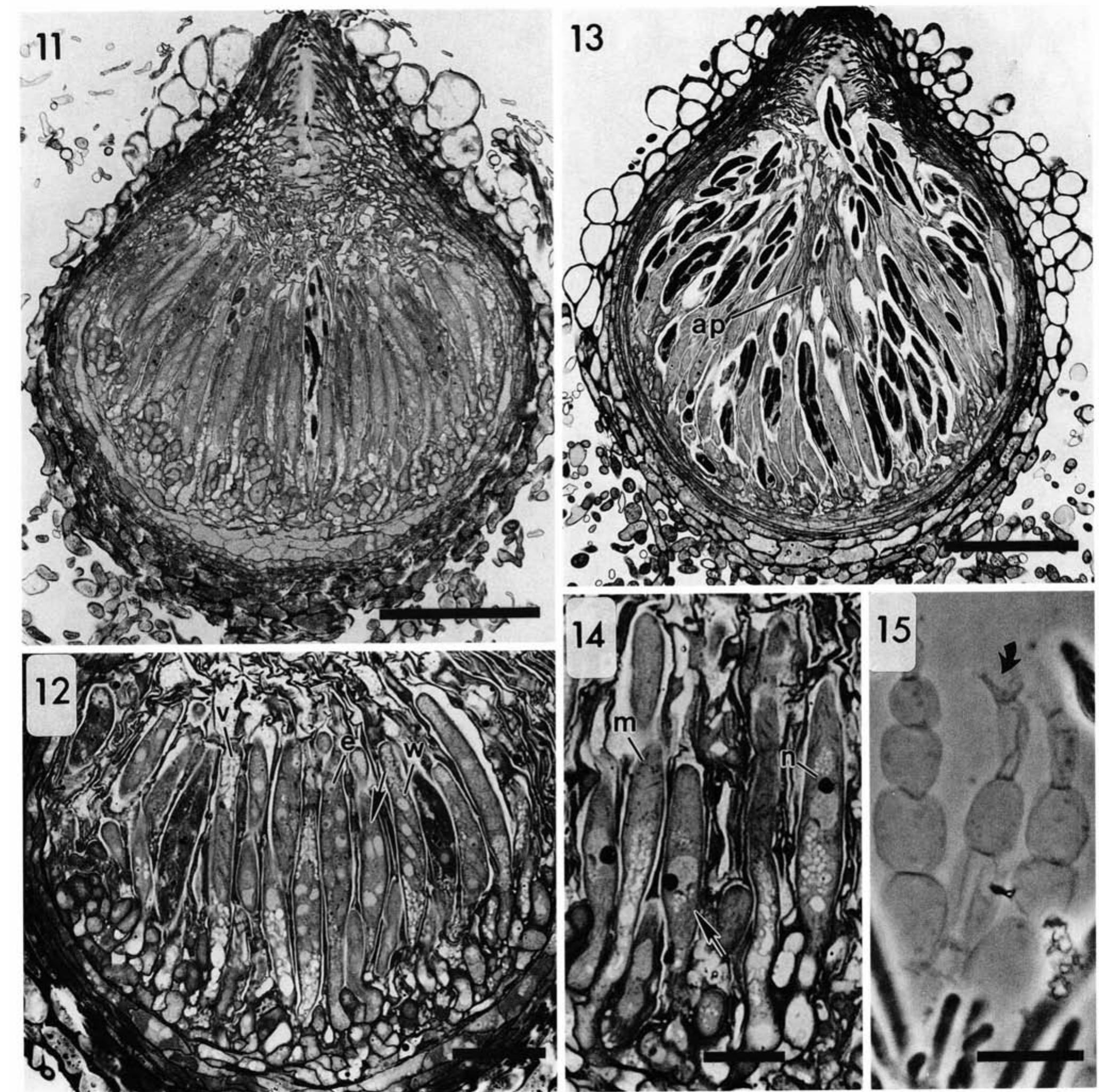 (PDF) Perithecial Development by Gibberella zeae: A Light Microscopy Study