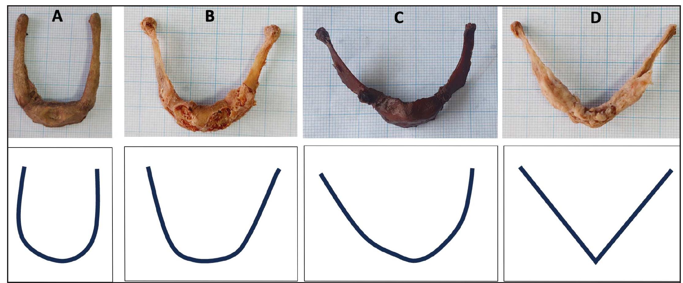 (PDF) Morphological and Morphometric Variations of the Hyoid Bone in ...