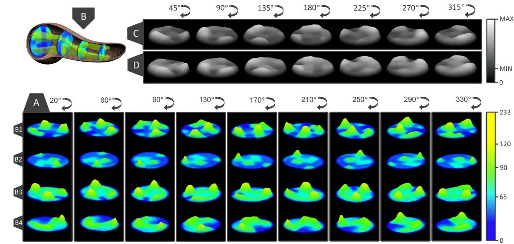 (PDF) A 3D map of the islet routes throughout the healthy human pancreas