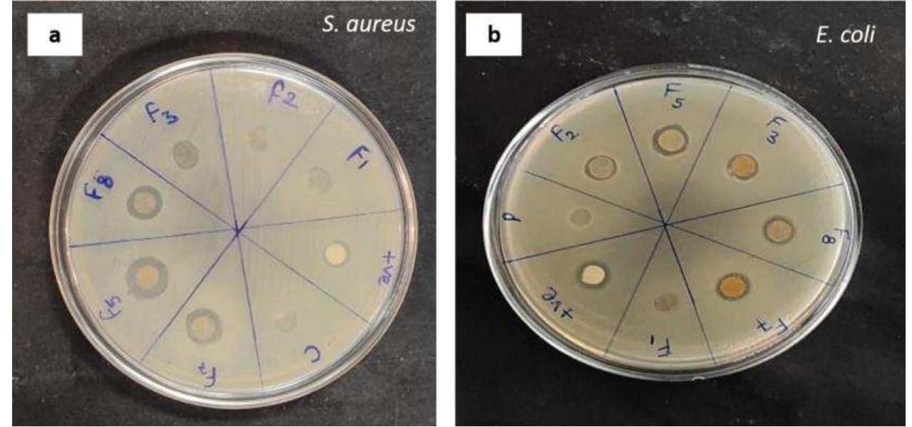 Inhibition zones of the biocomposite film discs (a)s. aureus