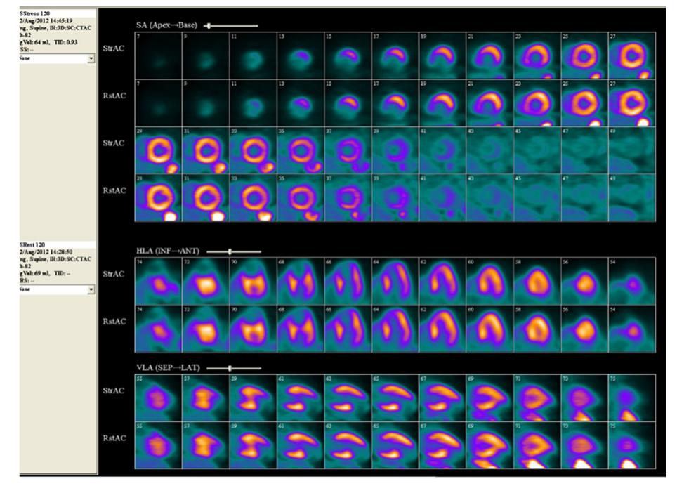 Fixed Inferior Defect Chart Figure 1 - from The yield, safety and prognostic value of