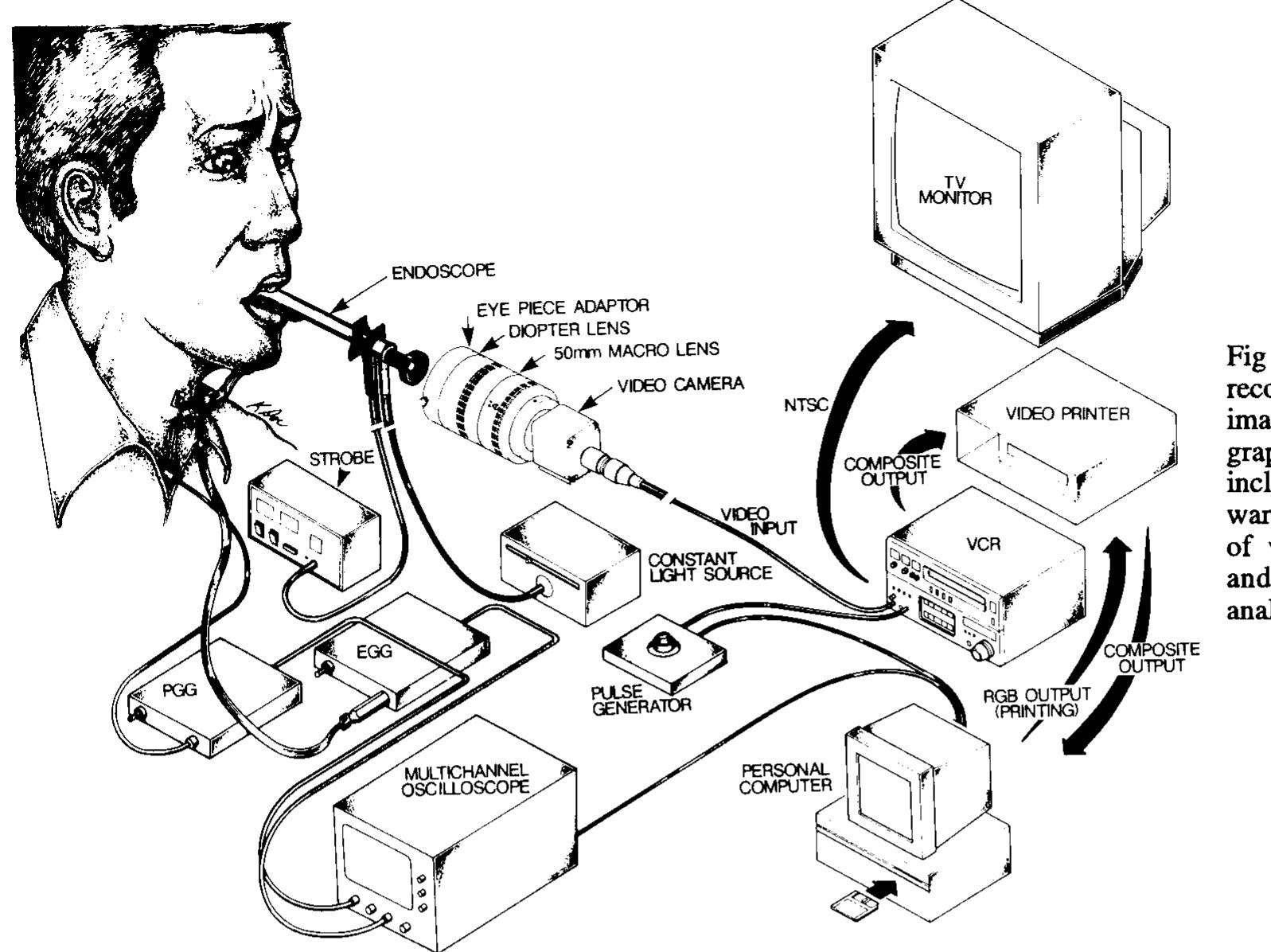 (PDF) Videostroboscopy of Human Vocal Fold Paralysis