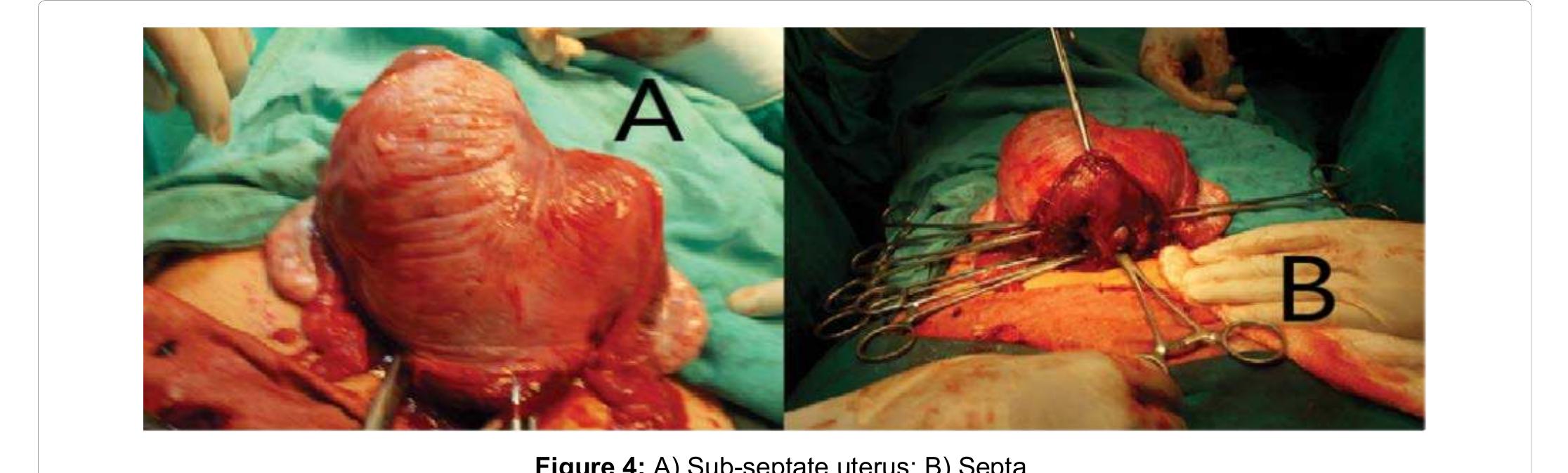 Figure 4 - Clinical Implications and ESHRE/ESGE