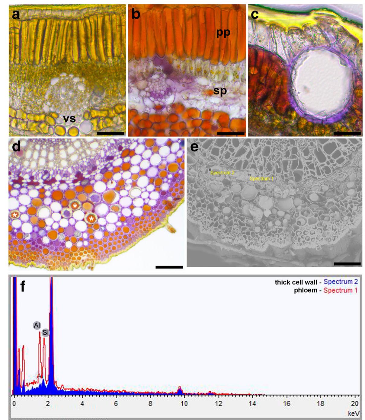 (PDF) X-ray spectra in SEM and staining with chrome azurol S show Al ...