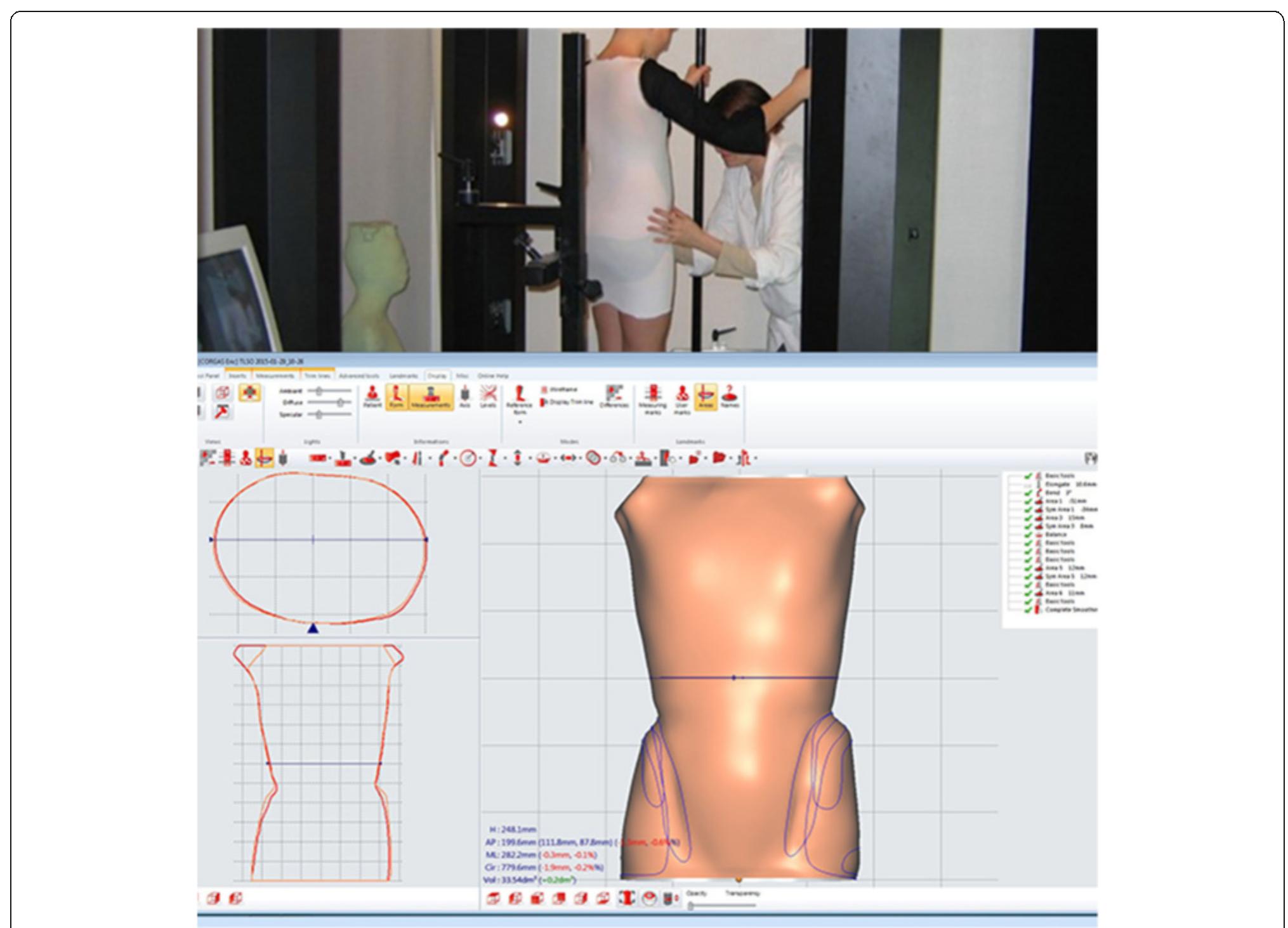 Cad/cam system with shape capture and shape processing