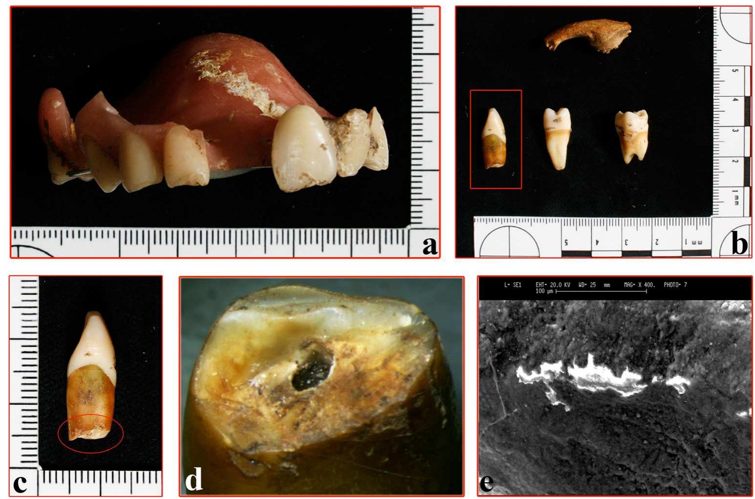 Case | and 2 are quite similar and represent a clear example of the importance of morphological analysis, as well as a warning on the use and handling of the reliability of chemical methods. In both cases, analysis with SEM-EDX and with 