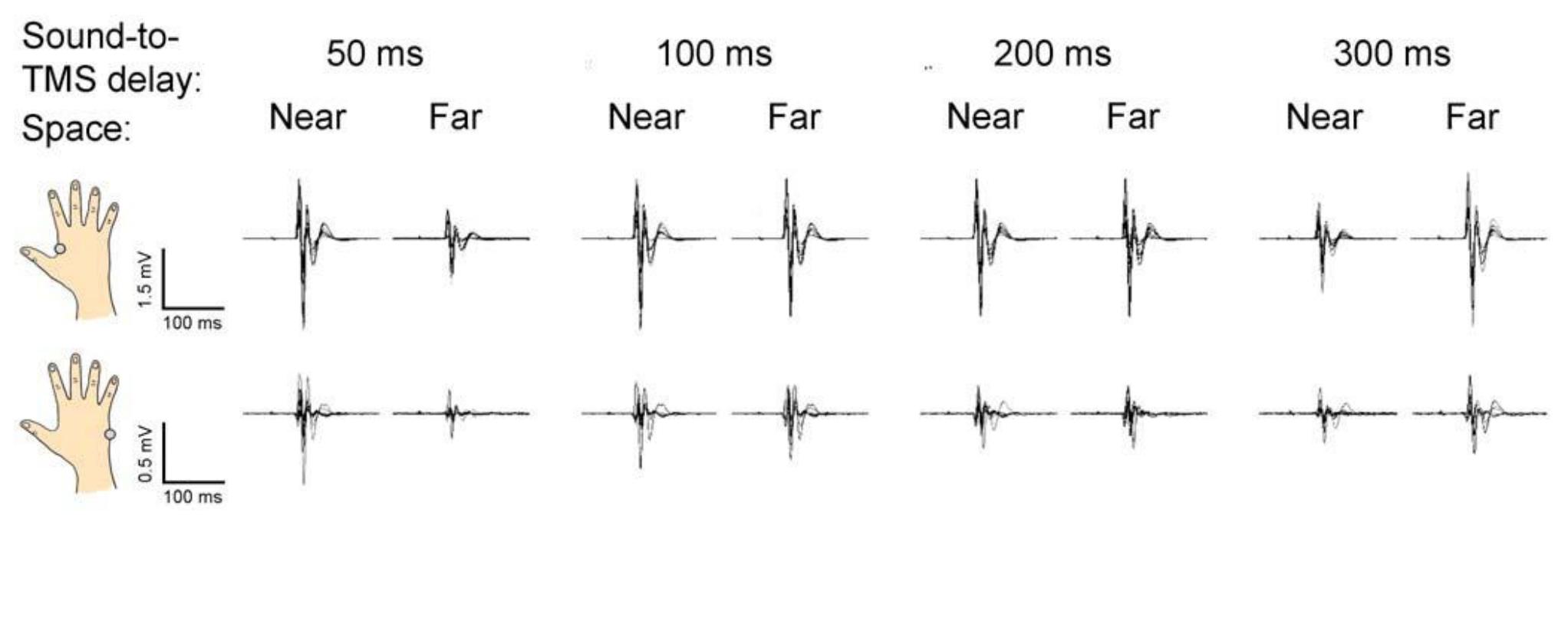 Figure 2.3. Raw MEPs amplitudes recorded from the FDI (top) and the ADM muscle (bottom) in one representative subject from Experiment | (only 120% rMT blocks are shown). (Adapted from Serino et al., 2009). 