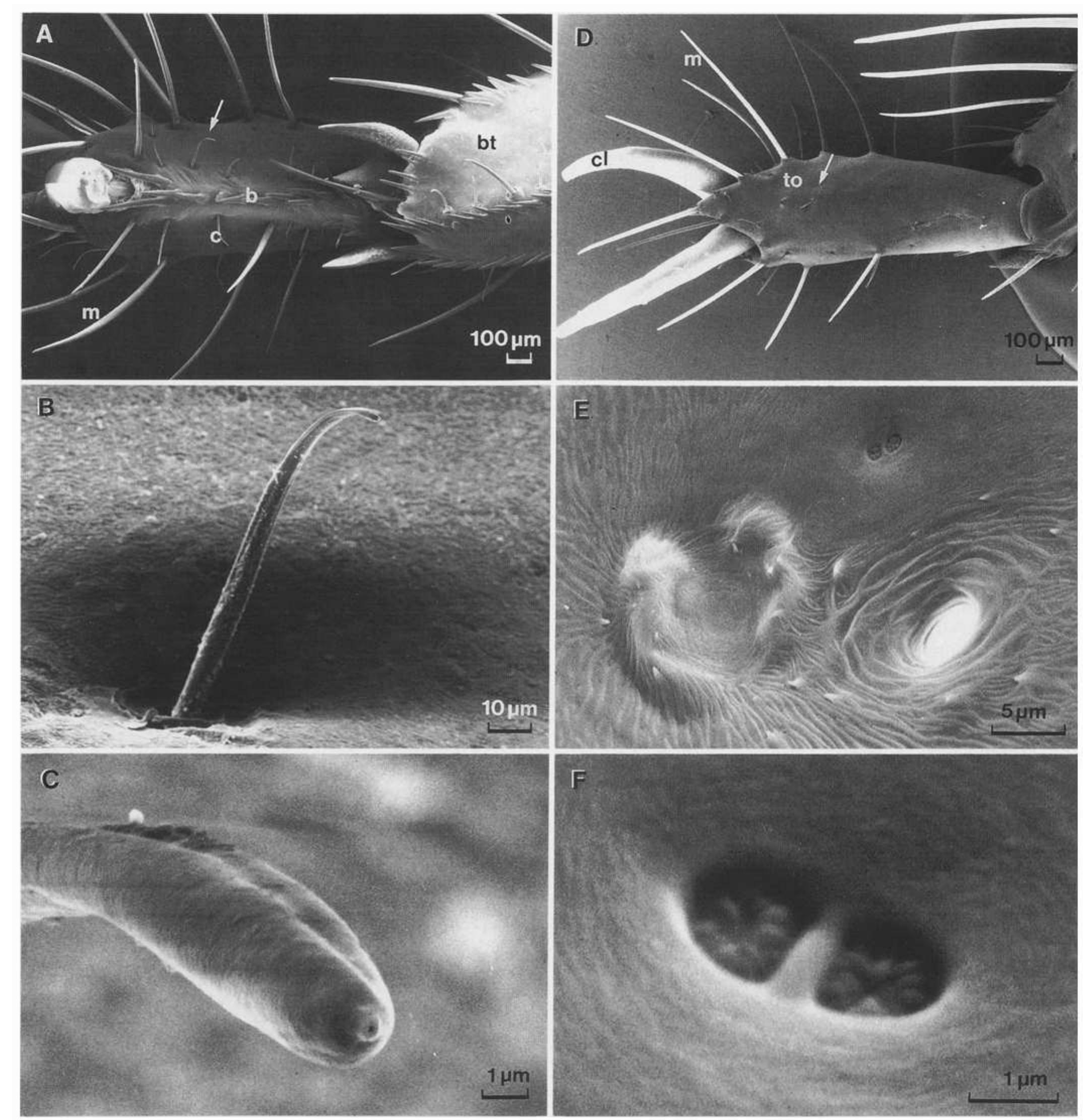 Pore morphologies. the larger pore, possibly a wax secreting