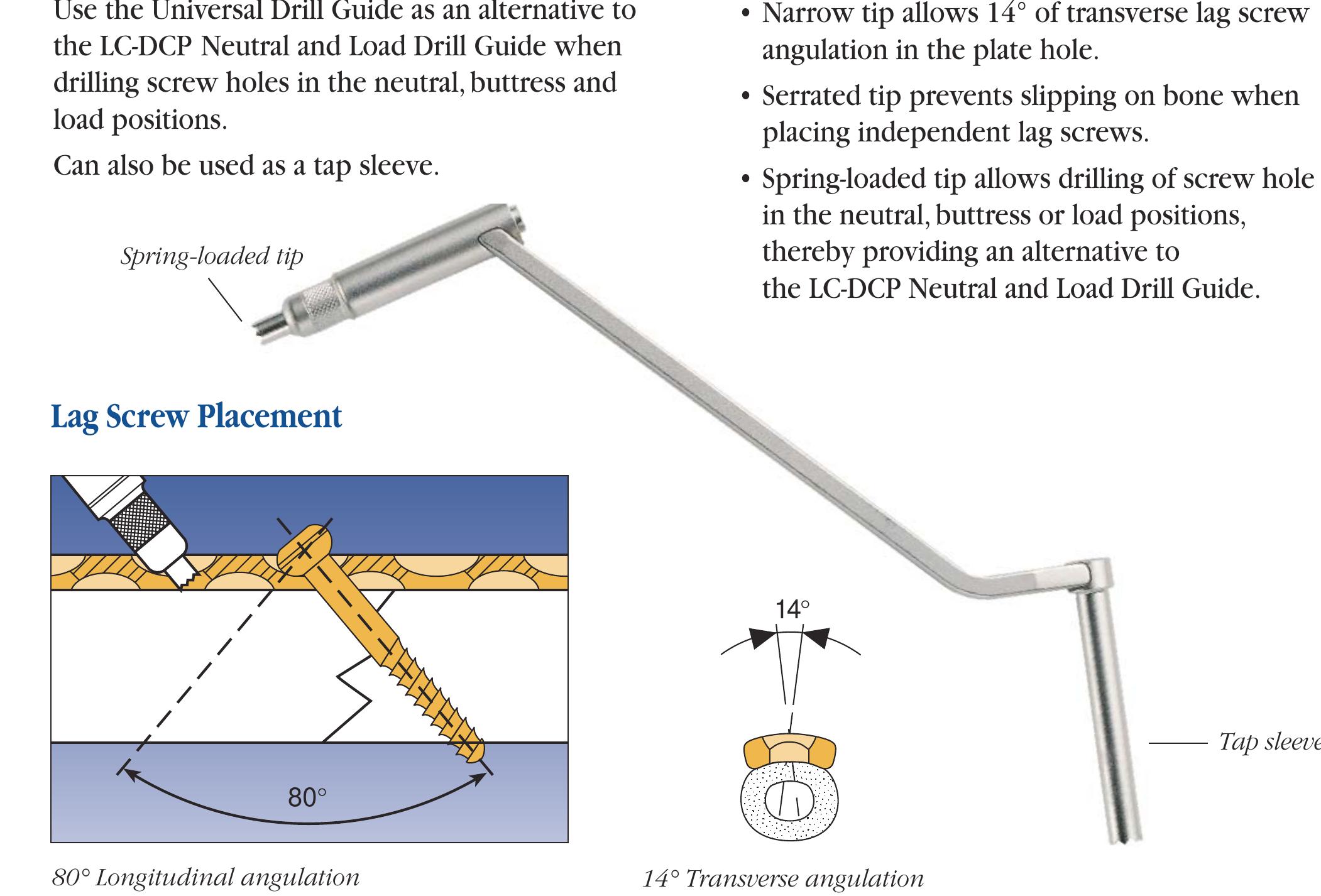 (PDF) The limited contact dynamic compression plate (LC-DCP)