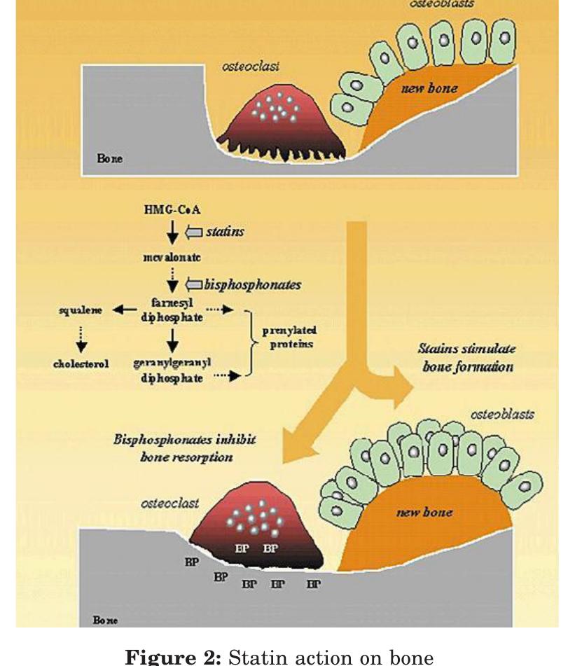 Afloat Fpp Modification (PDF) Statins in Periodontal Regeneration-The current Scenario