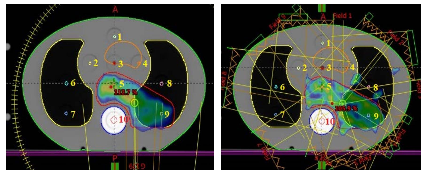 (PDF) Dosimetric verification of clinical radiotherapy treatment ...