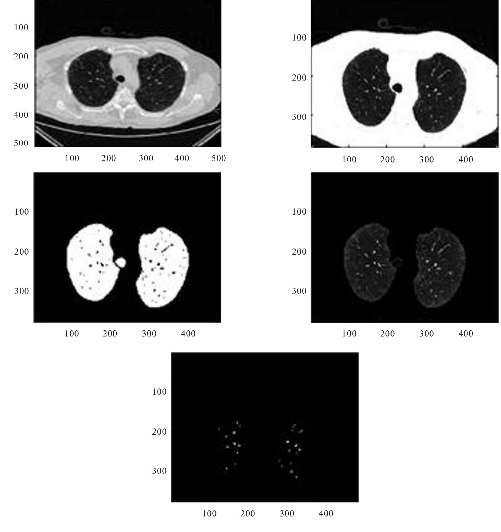 (PDF) Lungs Cancer Detection Using Digital Image Processing Techniques ...
