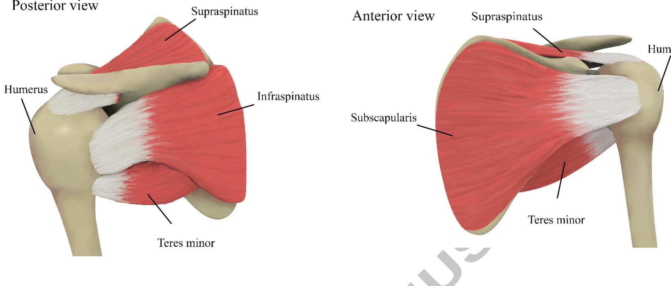 Figure 3 - from Nanofiber-based matrices for rotator cuff