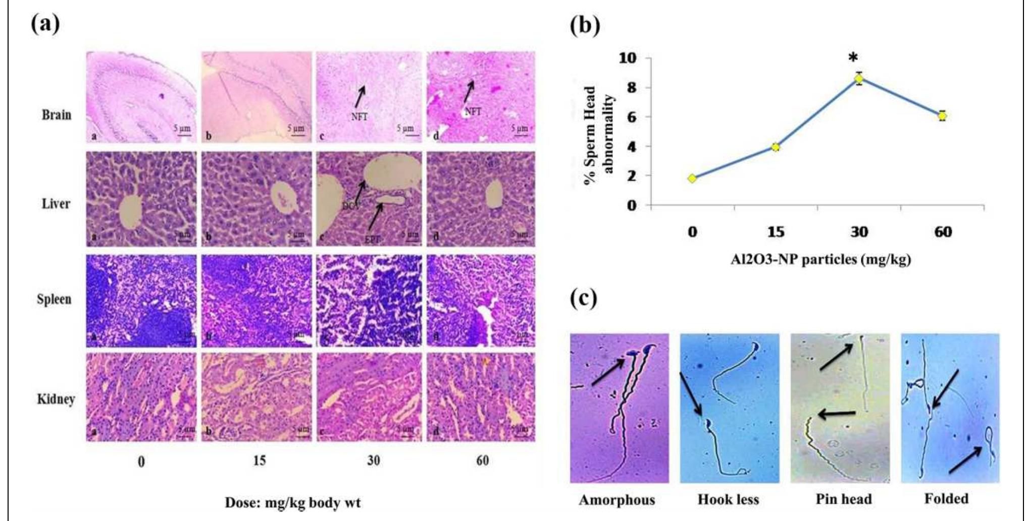 Photomicrographs of he stained sections of (a) brain, liver,