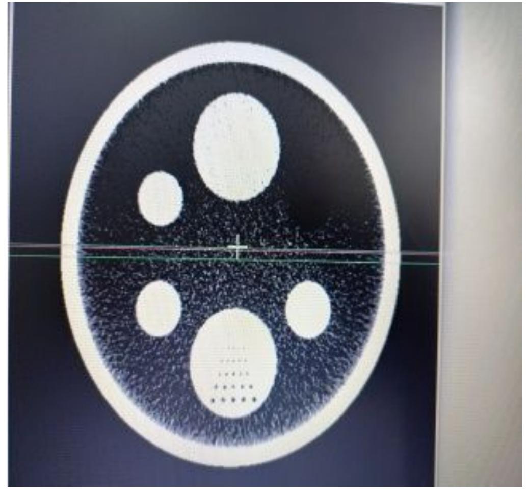 (PDF) CT scanner quality control using a quality assurance phantom and ...