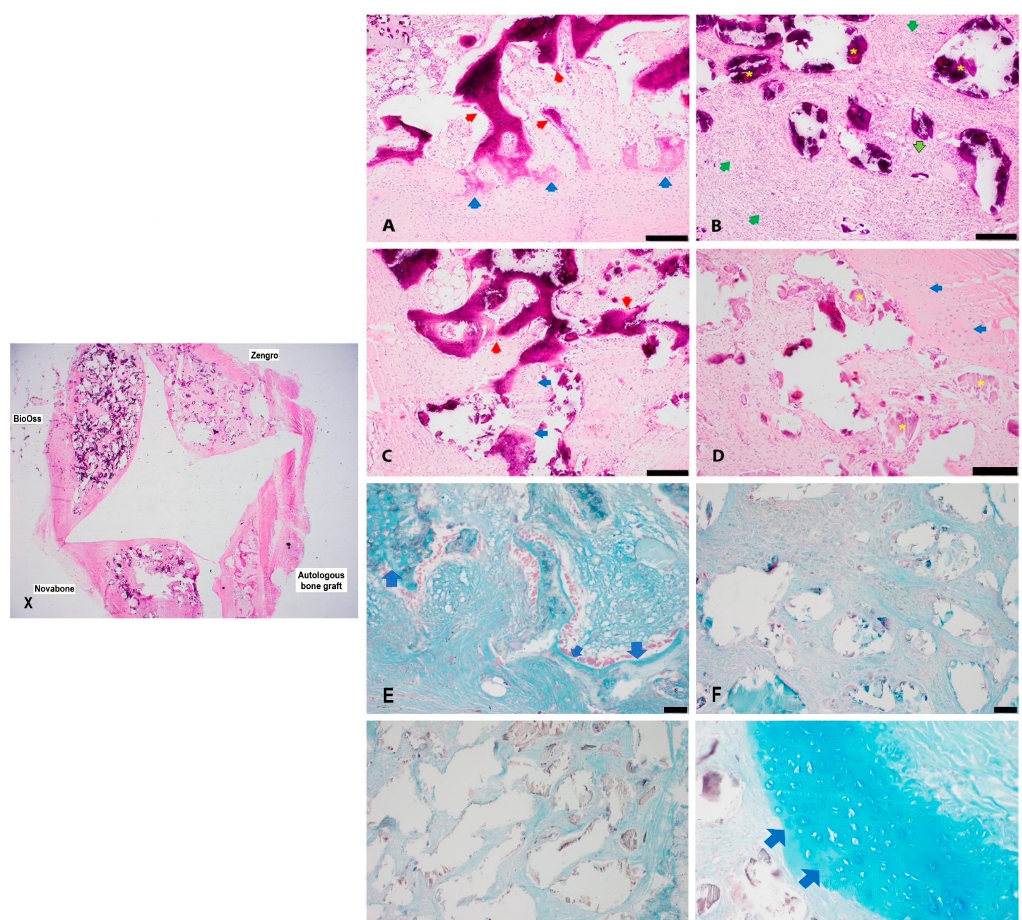 (PDF) A Comparison of In Vivo Bone Tissue Generation Using Calcium ...