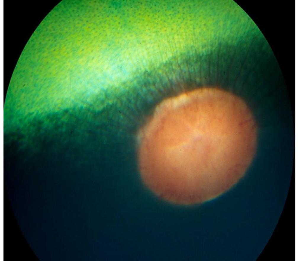 Normal equine ocular fundus. note the dorsal tapetum and