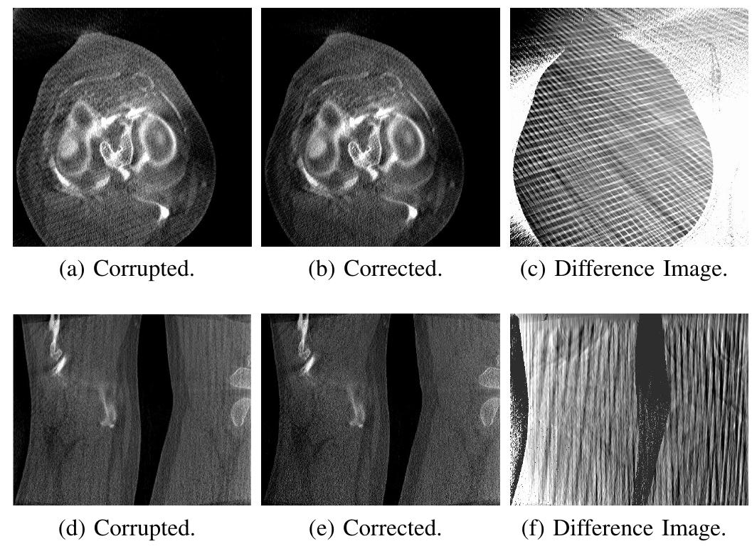 (PDF) Object removal in gradient domain of cone-beam CT projections