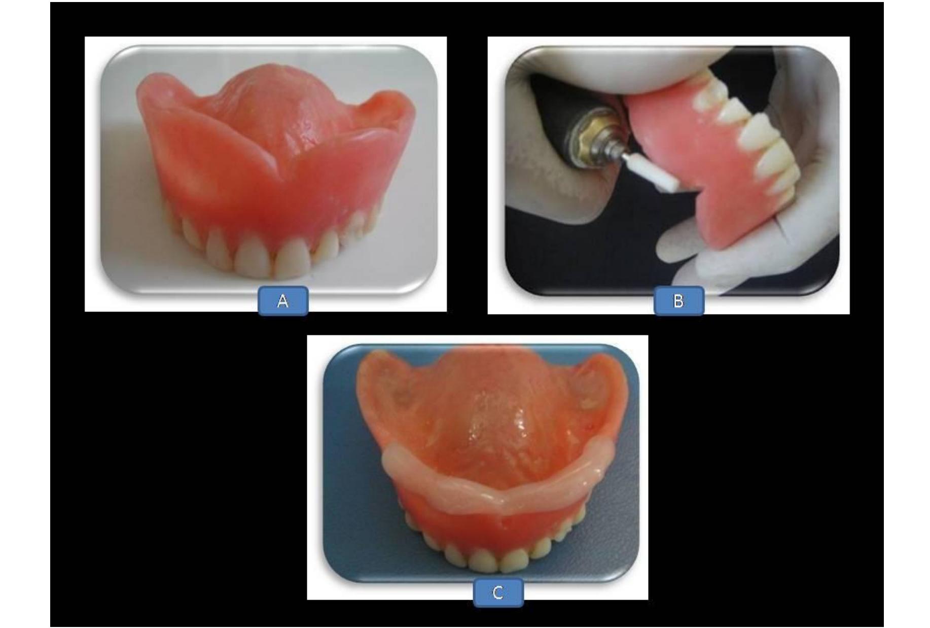 (PDF) Comparative evaluation of border morphology produced by three ...