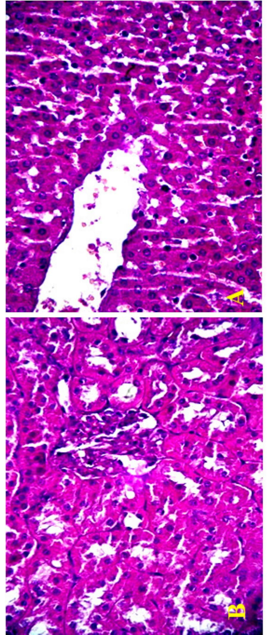 (PDF) HISTOPATHOLOGICAL CHANGES DUE TO TOXIC EFFECT OF AFLATOXIN B1 ON ...