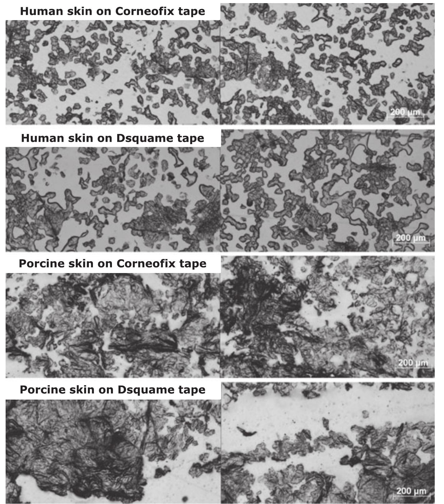 (PDF) Skin integrity testing and monitoring of in vitro tape stripping ...