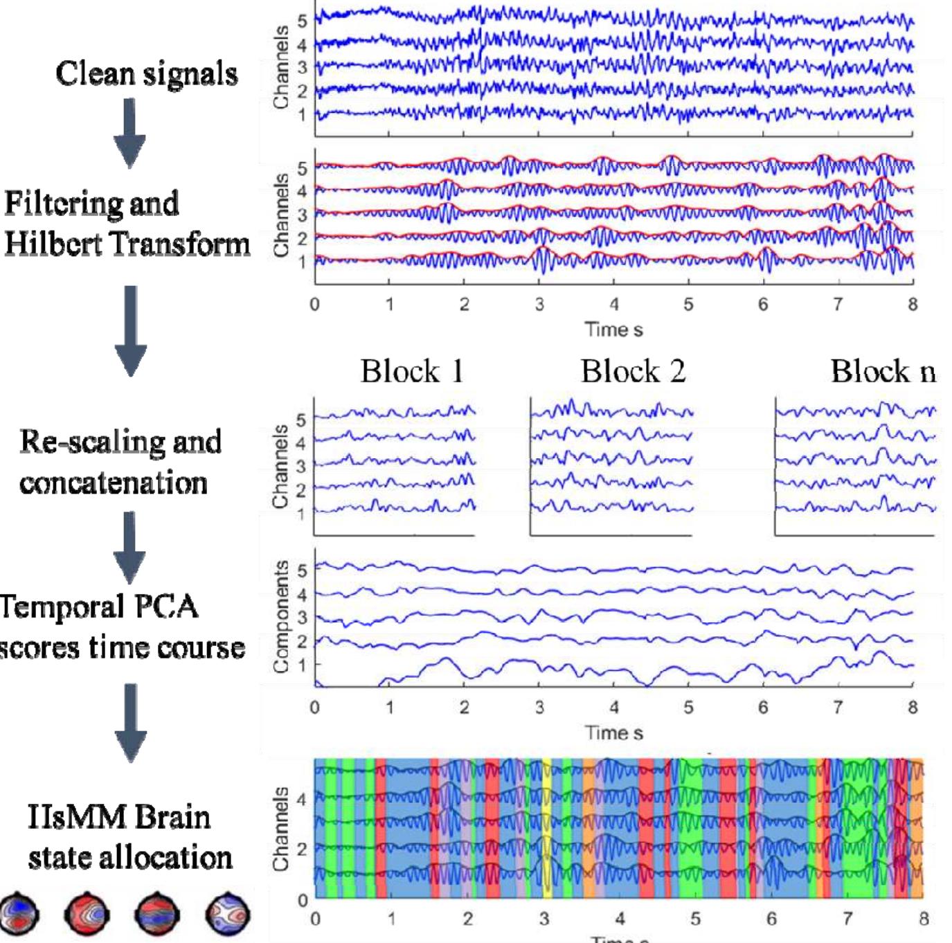 (PDF) Modeling EEG Resting-State Brain Dynamics: A proof of concept for ...