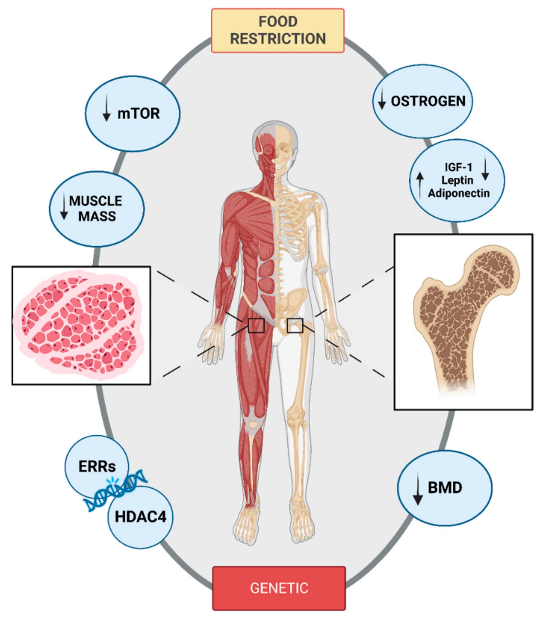 (PDF) The Impact of Anorexia Nervosa and the Basis for Non ...